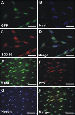 Co-transplantation of Epidermal Neural Crest Stem Cells and Olfactory Ensheathing Cells Repairs Sciatic Nerve Defects in Rats